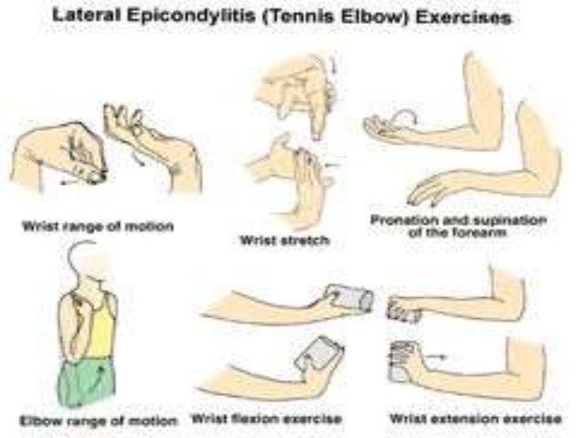 tennis elbow exercises pdf kaiser